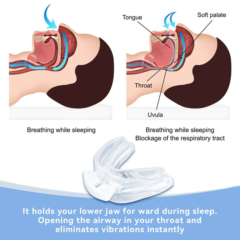 Soft Silicone Anti-Snore Device