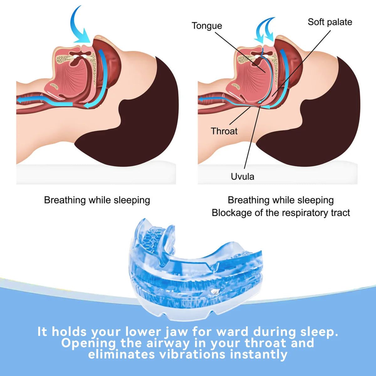 Sleep Apnea Mouthpiece Guard